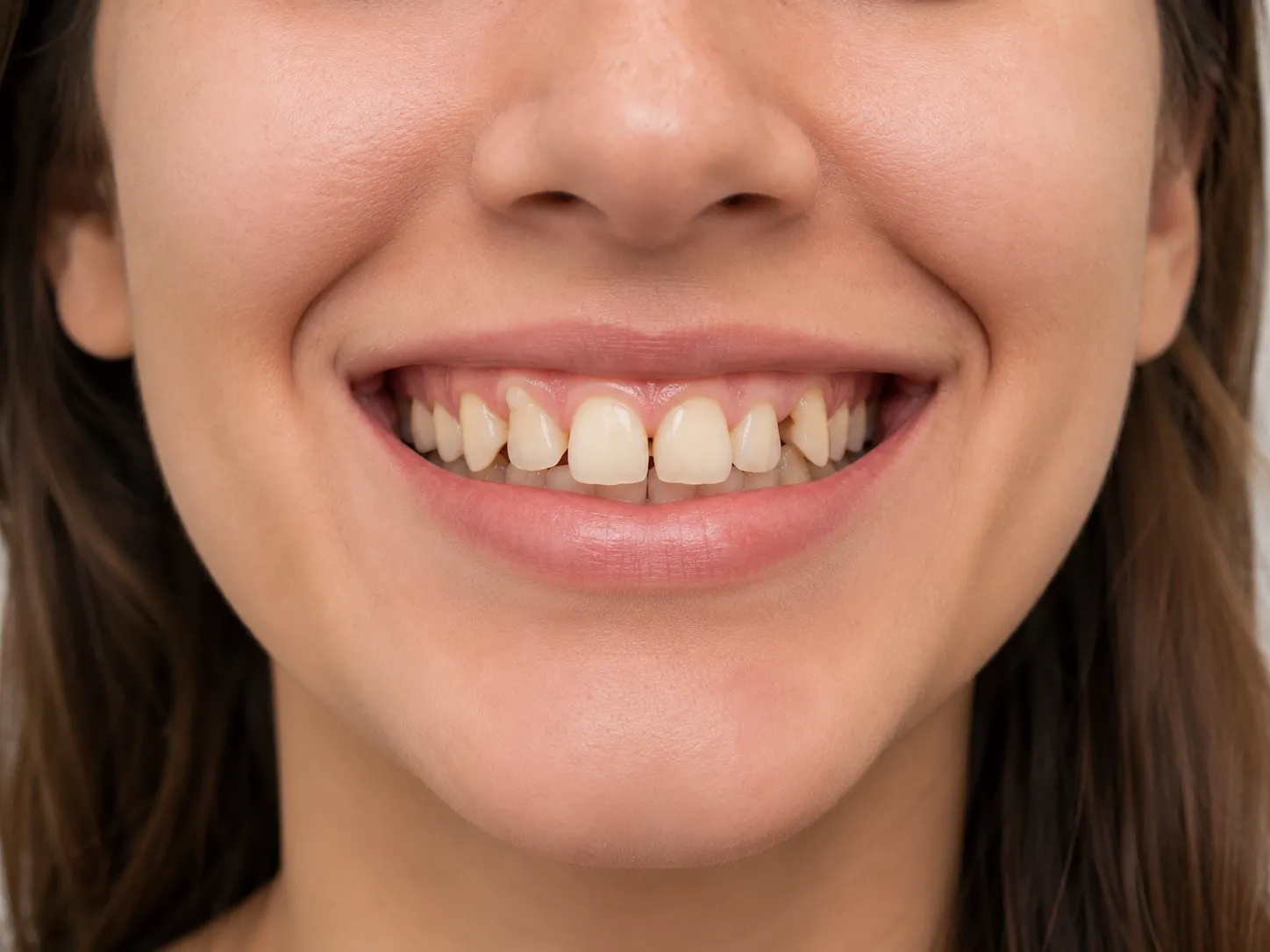 Case 01 — smile before treatment
